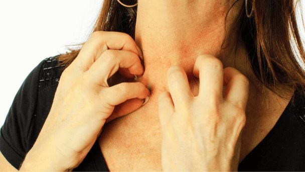 Picor de la piel como síntoma de alerta en el cáncer de páncreas Picor de la piel como síntoma de alerta en el cáncer de páncreas