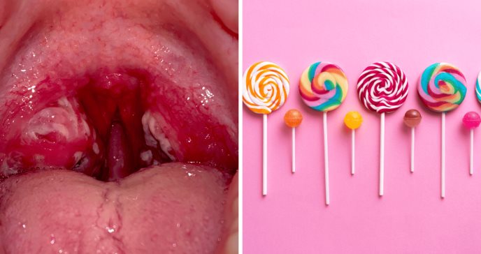 Paletas para detectar enfermedades: ¿Cómo funciona este novedoso sistema basado en saliva?