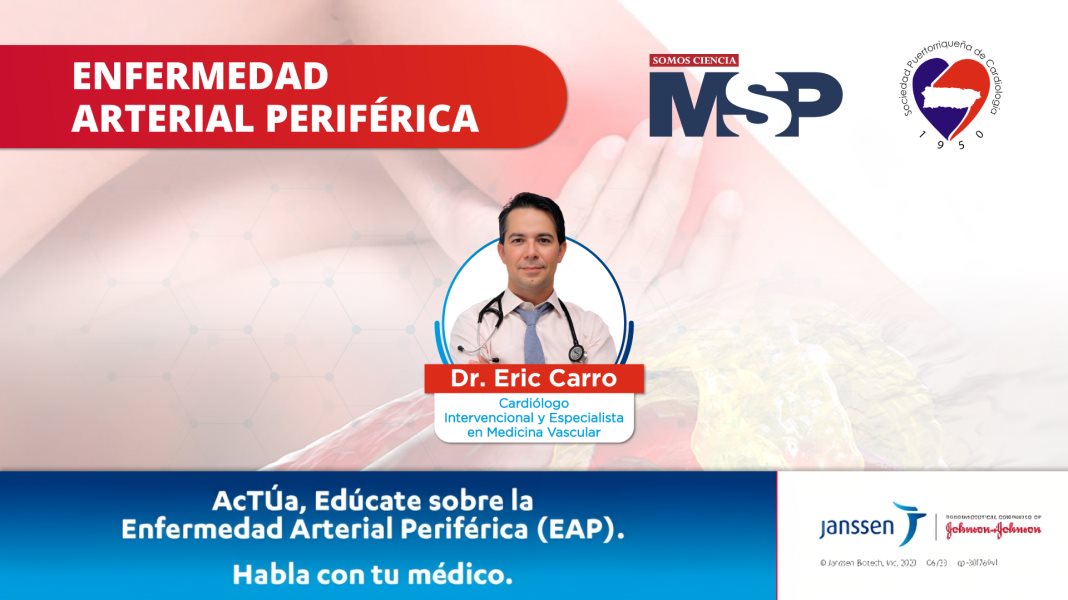 Enfermedad Arterial Periférica: prevención y tratamiento | #ProgramaEspecial
