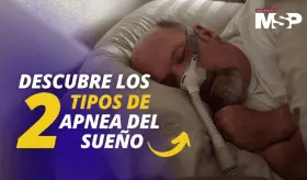 Los 2 tipos de apnea del sueño que podrías padecer - #ExclusivoMSP