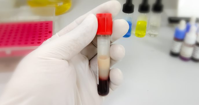 Niveles fluctuantes de colesterol y triglicéridos podrían ser un marcador de riesgo de demencia: estudio