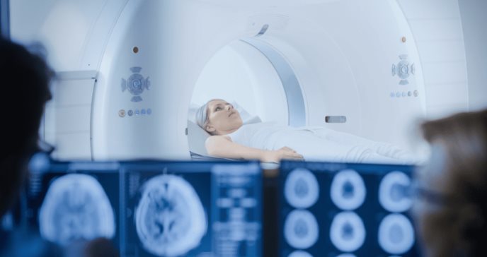 Estudio evidencia que el meningioma aumenta 10 veces el riesgo de padecer cáncer de mama