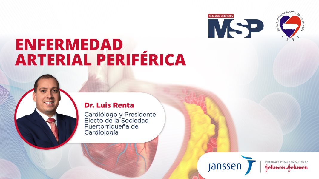 Enfermedad arterial periférica