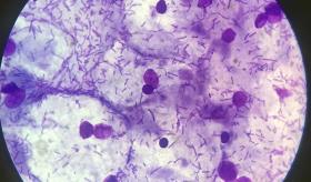 Cistitis, vulvovaginitis y vaginosis: consecuencias de microbiota vaginal alterada