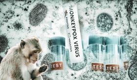 Las 4 epidemias zoonóticas más letales para la raza humana