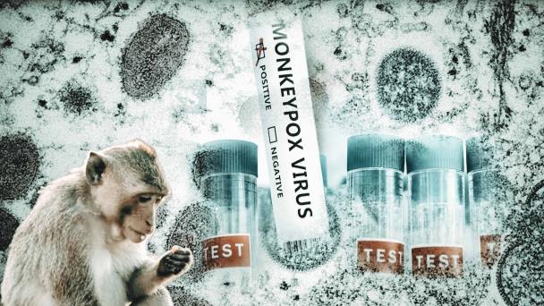 Las 4 epidemias zoonóticas más letales para la raza humana