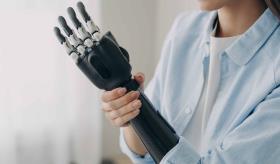 ¡Logro histórico! Persona con prótesis de mano biónica manipula cada dedo como si fuera la suya propia