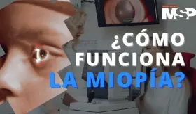 &iquest;C&oacute;mo funciona la miop&iacute;a? - #ExclusivoMSP