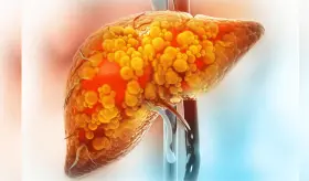 Conozca las señales de advertencia que indican problemas en el hígado