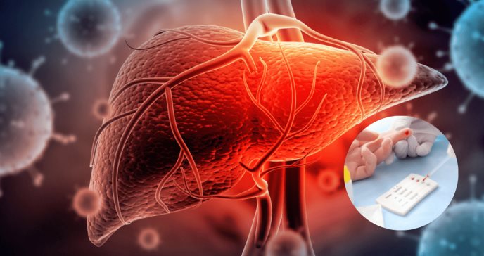 OMS: En el 2040 la hepatitis podría cobrar más vidas que la malaria, tuberculosis y VIH juntos