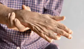 Radiculopatía o nervio pinzado: lo que ocurre cuando los nervios se comprimen por exceso de presión