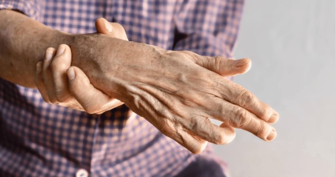 Radiculopatía o nervio pinzado: lo que ocurre cuando los nervios se comprimen por exceso de presión
