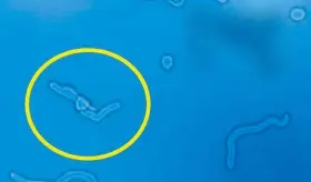 Moscas volantes: una afecci&oacute;n ocular que puede se&ntilde;alar un desprendimiento de retina