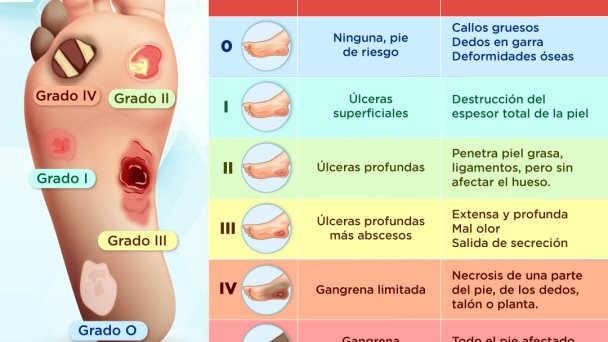 Escala de Wagner | Infografía Escala de Wagner | Infografía