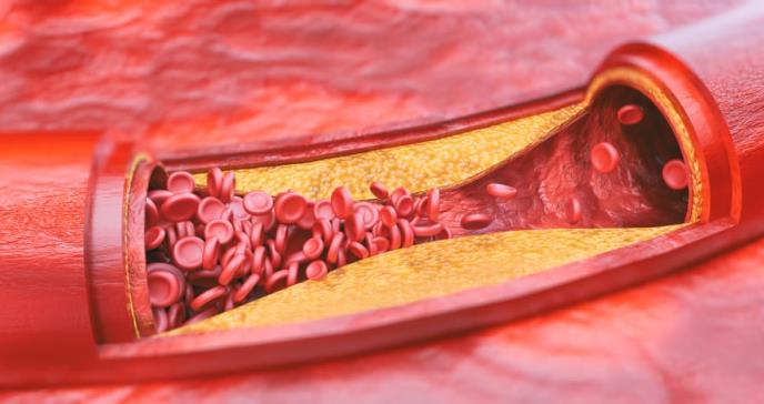 Cuidar la salud de su corazón podría ayudarle a prevenir enfermedades neurológicas como el Alzhéimer