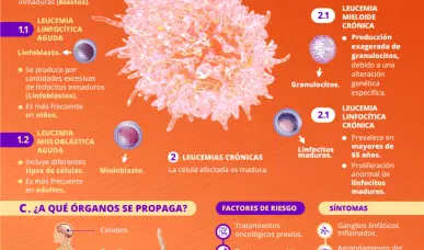 Leucemia | Infograf&iacute;a