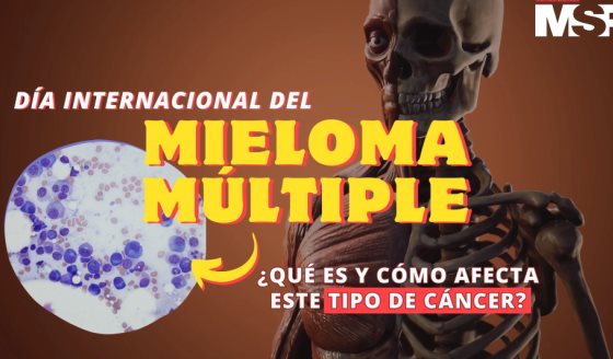 Día Internacional del Mieloma Múltiple | ¿Qué es y cómo afecta este tipo de cáncer?