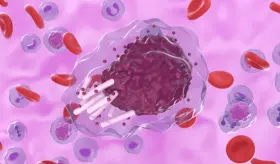 Linfoma linfocítico pequeño: cáncer inmunológico que puede afectar cualquier órgano