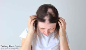 La alopecia: causas más comunes y su tratamiento