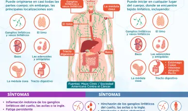 Linfoma de Hodgkin VS Linfoma de no Hodgkin | Infograf&iacute;a