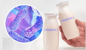 Consumo de probióticos en embarazo y niñez podría prevenir trastornos dermatológicos o gastrointestinales