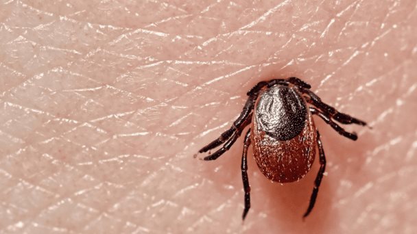 Infección transmitida por garrapatas: ¿Qué consecuencias genera la enfermedad de Lyme? Infección transmitida por garrapatas: ¿Qué consecuencias genera la enfermedad de Lyme?
