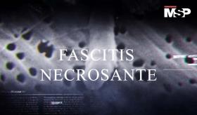 Bacteria "come carne" causa la amputación de 4 extremidades a Laura Barajas- #MSPSerie #Capítulo 12