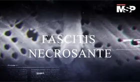 Bacteria "come carne" causa la amputación de 4 extremidades a Laura Barajas- #MSPSerie #Capítulo 12