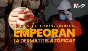 ¿Sabías que ciertos trabajos empeoran la dermatitis atópica? - #ExpertosEnSalud