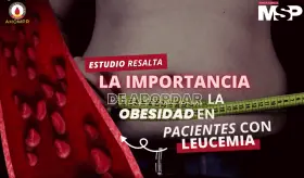 Estudio resalta la importancia de abordar la obesidad en pacientes con leucemia - #EspecialMSP