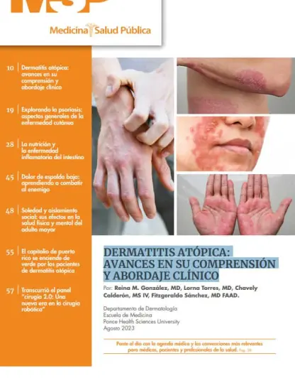 Dermatitis Atópica: Avances en su comprensión y abordaje clínico