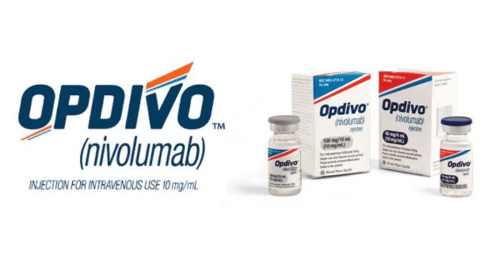 Opdivo combinado con quimioterapia reduce el riesgo de muerte en pacientes con cáncer urotelial avanzado