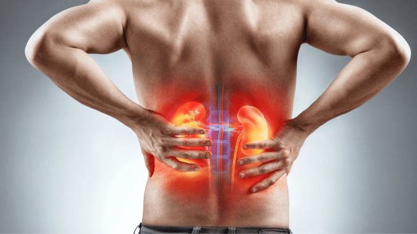 Tipos de cáncer de riñón: carcinoma de células renales representa el 90 % de los casos de cáncer renal Tipos de cáncer de riñón: carcinoma de células renales representa el 90 % de los casos de cáncer renal