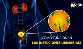 ¿Cómo funcionan las infecciones urinarias? - #ExclusivoMSP
