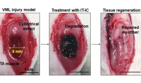 Desarrollan tejido inyectable biodegradable para sanar lesiones graves o recuperar daño muscular