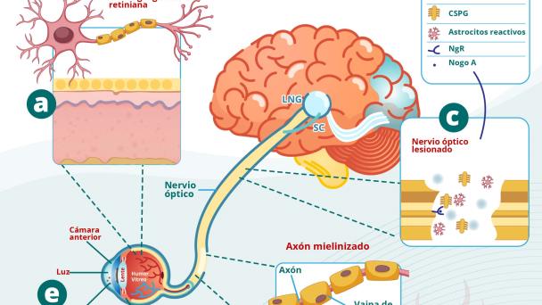 La retina como ventana al cerebro | Infografía La retina como ventana al cerebro | Infografía
