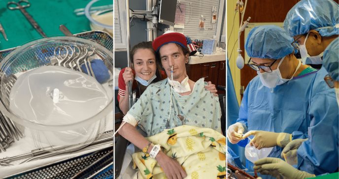 Implantes mamarios salvan la vida de hombre durante un doble trasplante de pulmón