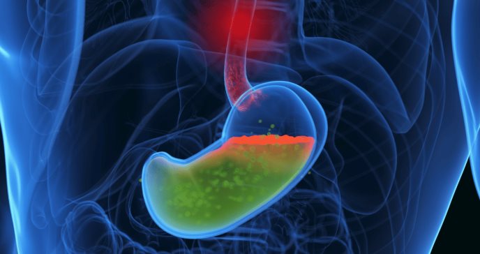 Tratamiento farmacológico y quirúrgico del reflujo se relaciona con menor riesgo de cáncer esofágico