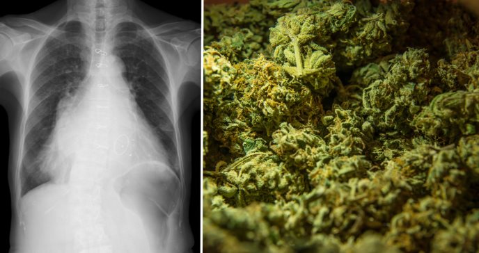 Consumo diario de marihuana aumenta el riesgo de infarto e insuficiencia cardíaca