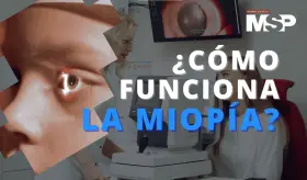 &iquest;Por qu&eacute; se ve borroso en la miop&iacute;a? - #ExclusivoMSP