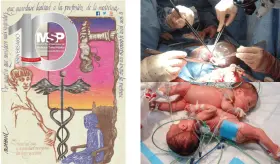 Primer trasplante de hígado y separación de siamesas en Puerto Rico: Los hitos de la Revista MSP impresa