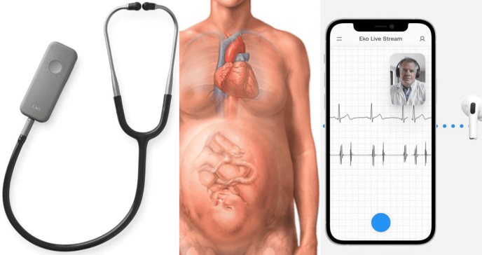 Estetoscopio inteligente revoluciona la detección de miocardiopatía periparto con inteligencia artificial
