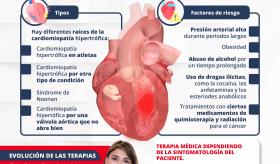 Tipos y tratamientos de la cardiomiopatía hipertrófica | Infografía