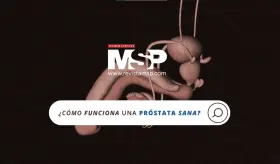 Así funciona una próstata sana y cómo prevenir el cáncer de próstata - #ExclusivoMSP