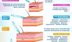 Tipos de inyecciones | Infografía