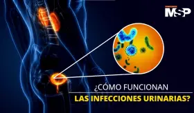 Así funcionan las bacterias que provocan infecciones urinarias - #ExclusivoMSP