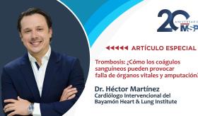 Trombosis: ¿Cómo los coágulos sanguíneos pueden provocar falla de órganos vitales y amputación?