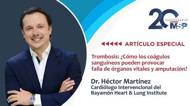Trombosis: ¿Cómo los coágulos sanguíneos pueden provocar falla de órganos vitales y amputación? Trombosis: ¿Cómo los coágulos sanguíneos pueden provocar falla de órganos vitales y amputación?