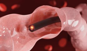 Conozca los tipos de endoscopia existentes y su función en cada órgano del cuerpo