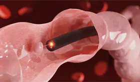 Conozca los tipos de endoscopia existentes y su función en cada órgano del cuerpo